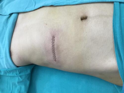 Scar