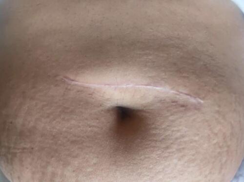 Wounds and Scars