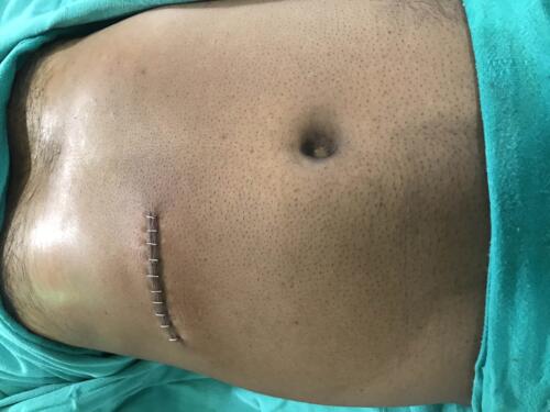 Scar
