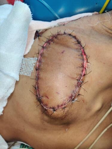 Scar